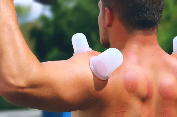 Silicon Cupping: Karleetus Protocol